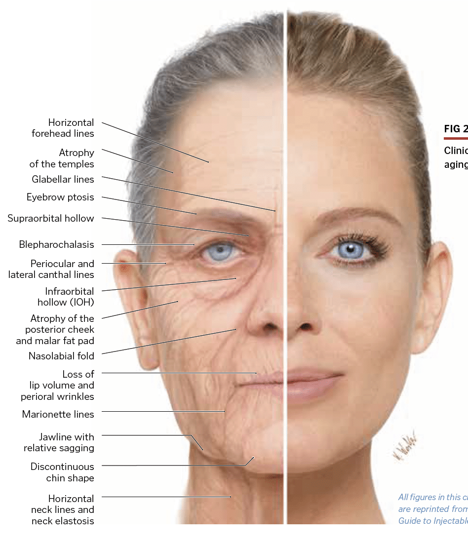 Basics To Facial Esthetics Facial Anatomy Care Esthetics