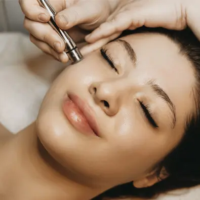 Microneedling procedure being performed on a patient's face.